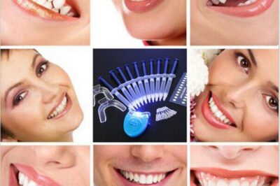 How Much is Professional Teeth Whitening?